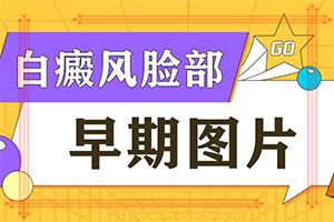 我的白斑为啥刚开始不清楚治疗中变的少了,发病的原因有哪些(哪些原因诱发呢)