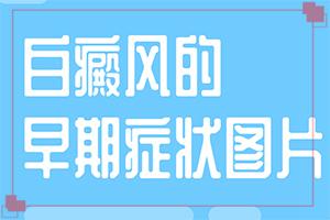 上眼皮下长了一个小白点-白癜风的起因详解