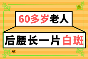 白癜风两年来总是治不好的原因是什么