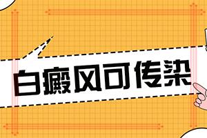 白癫风医生在线(白癞风可以在家治吗)