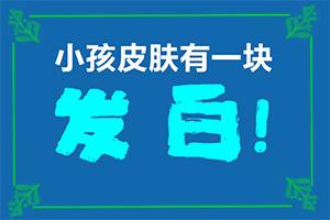 相似白颠疯的病(白癞风有什么治疗方法)