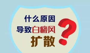 儿童白癜风患者饮食注意事项