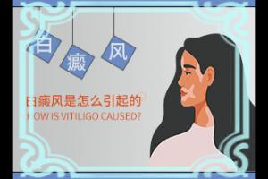 白癫风用什么药较好,治疗的方式是什么(白斑治疗常识有哪些)