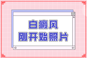 小儿白癫风能治的好吗以及如何治白点癫风