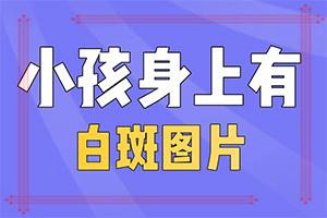 直径10厘米的白斑块是什么病,主要症状是什么(又有哪些症状表现呢)